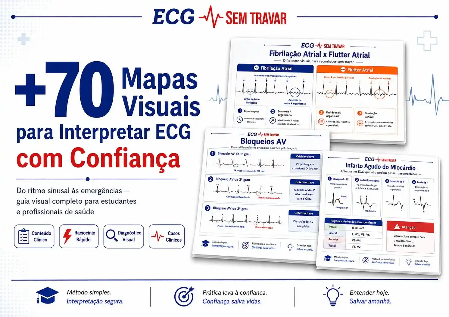 Fibrilação Atrial